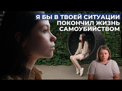 Видео: ПОСЛЕОЖОГОВЫЕ РУБЦЫ ТЕЛА | История Ренаты Степановой