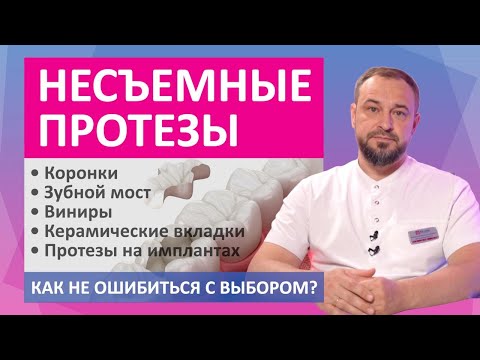 Видео: Несъемные зубные протезы: зубные коронки, мосты, виниры, керамические вкладки, протезы на имплантах