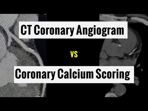 Видео: В чем разница между оценкой коронарного кальция и КТ-коронарографией (2023)?