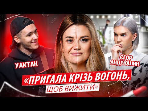 Видео: "Я ВТРАТИЛА ЧОЛОВІКА, А ТІЛО В ШРАМАХ" Повернення до життя після обстрілу. Проєкт Краса в тобі
