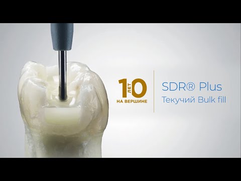 Видео: SDR®Plus 10 лет на вершине успеха!