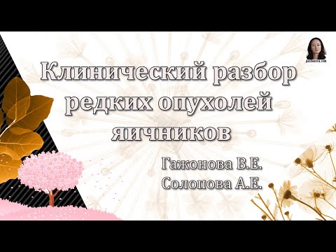 Видео: Клинический разбор редких опухолей яичников. Гажонова В.Е., Солопова А.Е.