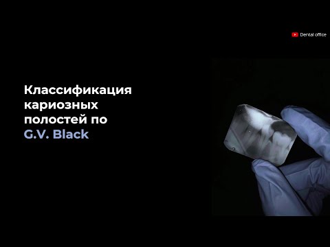 Видео: Классификация кариозных полостей по Блэку | G.V. Black's Classification of Carious | Кариесология