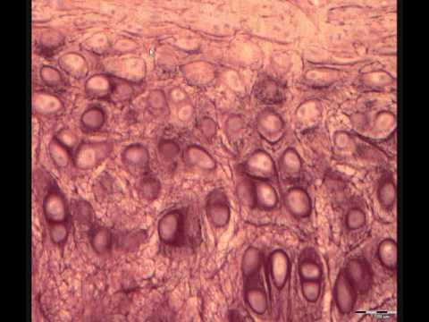 Видео: ЭЛАСТИЧЕСКИЙ ХРЯЩ В СВЕТОВОЙ МИКРОСКОП. ГИСТОЛОГИЧЕСКОЕ СТРОЕНИЕ