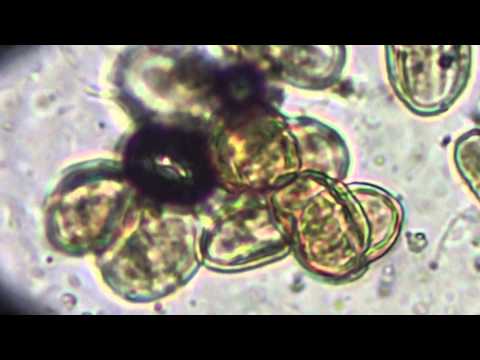 Видео: Мед Под Микроскопом: Опыт 1: Х400 Пыльца из Обножки, Honey & Flower Pollen Under Microscope, Kyiv