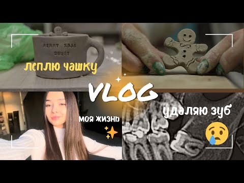 Видео: #1 влог: удаляю зуб 🦷 - опухла щека | леплю из глины | съёмки | покупки | рассказываю о себе 💛
