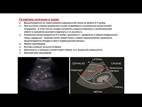 Видео: Ультразвуковая диагностика (УЗИ). Доктор Иогансен. Выпуск 59. Методика УЗИ селезенки.