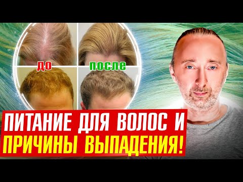 Видео: Как вырастить ВОЛОСЫ? Лучшее видео про волосы!