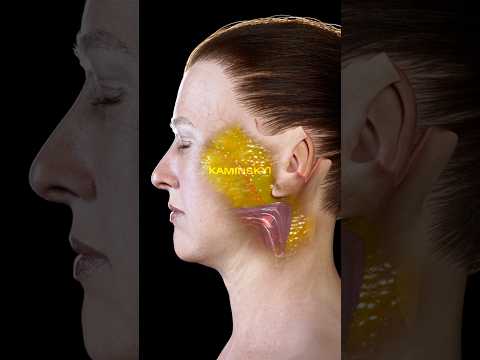 Видео: Не моложе, а лучше. Что может сделать подтяжка лица ⭕️ КАМИНСКИЙ