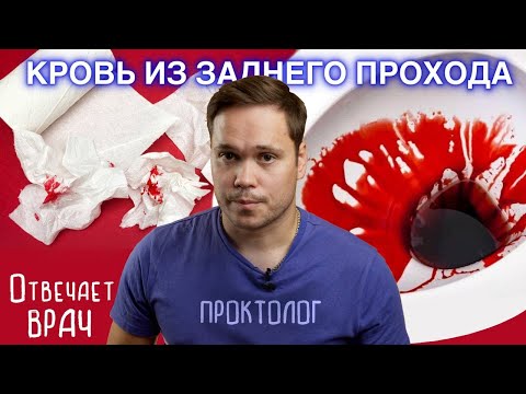 Видео: ПРИЧИНЫ КРОВИ ИЗ ЗАДНЕГО ПРОХОДА. Объясняет врач проктолог