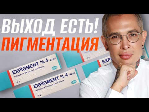 Видео: РЕАЛЬНОЕ ЛЕЧЕНИЕ ПИГМЕНТАЦИИ #косметолог #пигментация