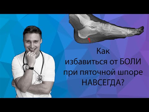 Видео: Как избавиться НАВСЕГДА от БОЛИ при ПЯТОЧНОЙ ШПОРЕ: народное средство