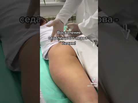 Видео: Лечим воспаление седалищного нерва.