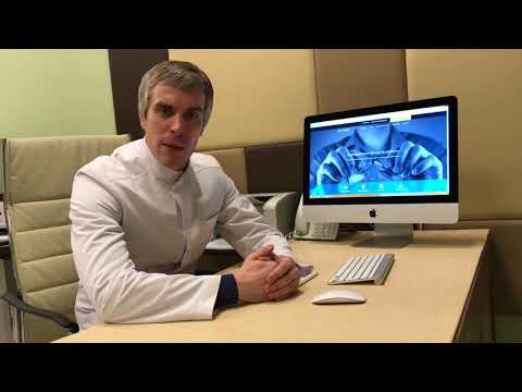 Видео: Правильно планируем подход к офтальмологу при эндокринной офтальмопатии