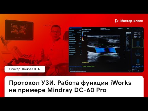 Видео: Протокол УЗИ. Работа функции iWorks на примере Mindray DC-60 Pro