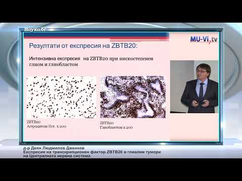 Видео: Експресия на транскрипционен фактор ZBTB20 в глиални тумори на Централната нервна система