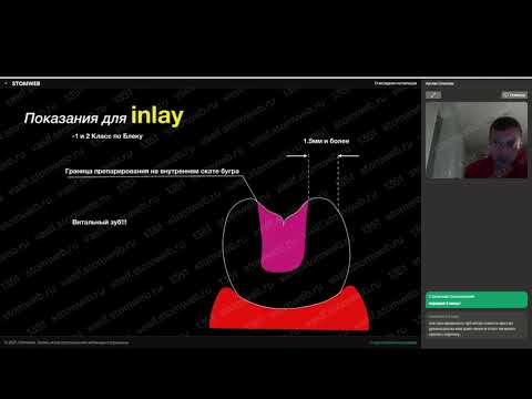 Видео: Артём Олексик - о вкладках на пальцах