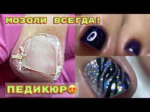 Видео: Педикюр 💅 Вычищаем постоянные подногтевые мозоли 💅 Тигровый дизайн ногтей