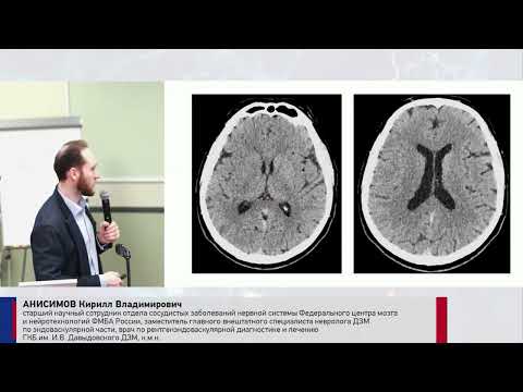 Видео: Анисимов К.В. Клинические примеры. Что изменили новые рекомендации в алгоритмах лечения пациентов?