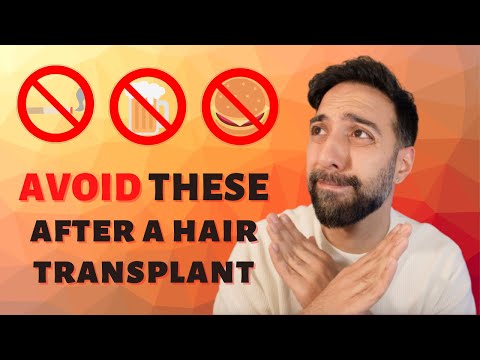 Видео: 8 ВЕЩЕЙ, КОТОРЫХ НУЖНО ИЗБЕГАТЬ ПОСЛЕ ПЕРЕСАДКИ ВОЛОС (для более быстрого восстановления)