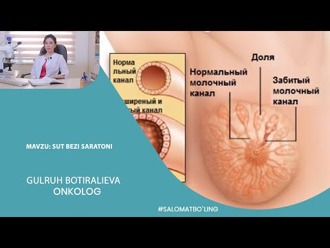 Видео: Кўкрак бези саратони. Аёлларда кўп учрайдиган касаллик.