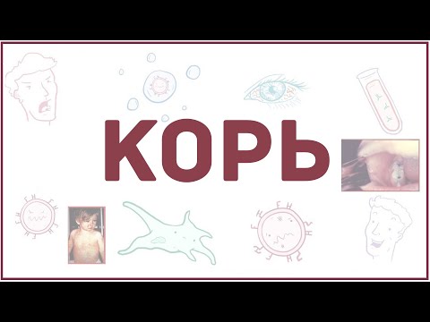 Видео: Корь - причины, симптомы, диагностика, лечение