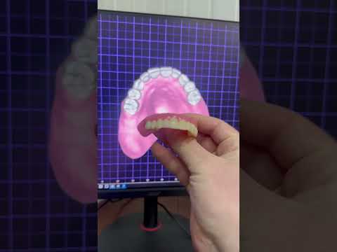 Видео: Фрезерований протез CAD/CAM в ExoCad