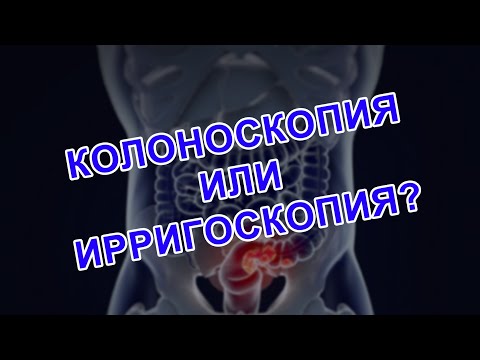 Видео: КОЛОНОСКОПИЯ ИЛИ ИРРИГОСКОПИЯ | ОТВЕТЫ НА ВОПРОСЫ В КОММЕНТАРИЯХ