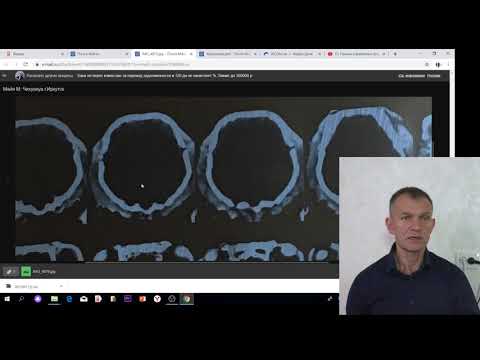 Видео: Как переслать исследования через интернет.