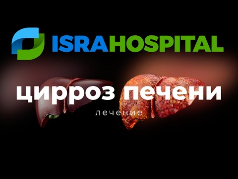 Видео: Лечение цирроза печени