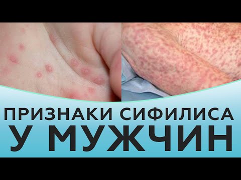 Видео: Признаки сифилиса у мужчин