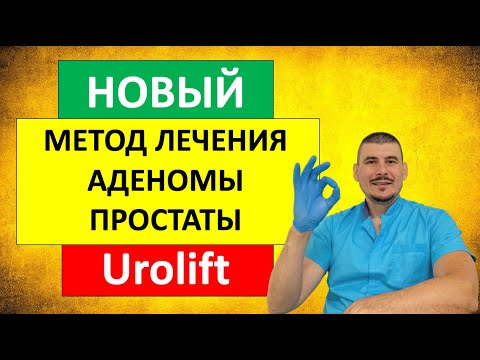 Видео: Новый метод лечения аденомы простаты - UROLIFT(уролифт)