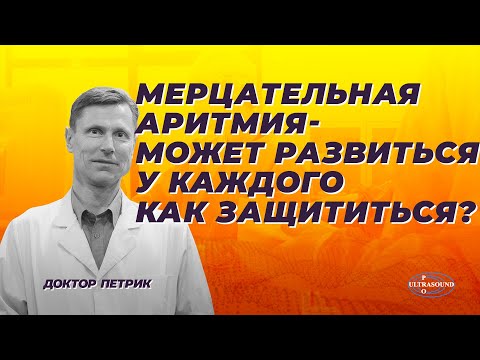 Видео: Мерцательная аритмия может развиться у каждого. Как защититься от тяжелых последствий.