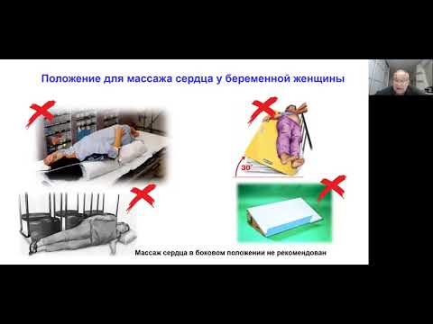Видео: Александр Куликов: кесарево сечение при внезапной остановке кровообращения / journal_vit