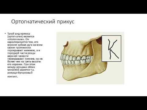 Видео: Прикус и разновидности  прикуса