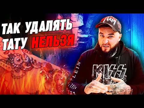 Видео: Удаление татуировки лазером – вся правда! / Как разводят людей на удалении тату?