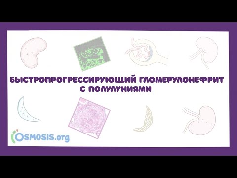 Видео: Быстропрогрессирующий гломерулонефрит с полулуниями - причины, симптомы, лечение (лекция)