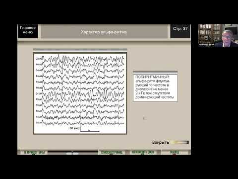 Видео: ЭЭГ-анализ продолжение