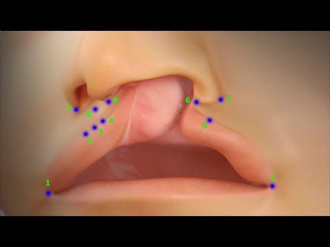 Видео: Рельефный ремонт губ - хирургическая маркировка