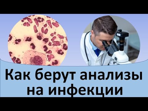 Видео: Как берут анализы на половые инфекции