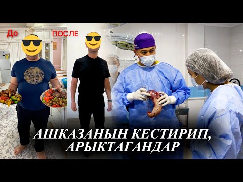 Видео: “Кыргызстанда 85-213 кг салмактагы адамдар ашказанын кестирип,арыкташат”