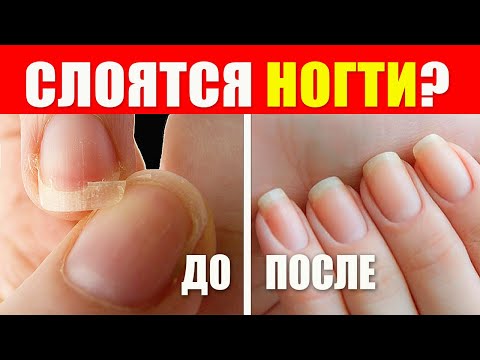 Видео: 💔 Почему Ваши Ногти Ломаются? Откройте Секреты Ухода! 💅