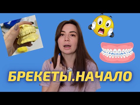 Видео: Брекеты в 36 лет.  Начало 24.12.2021. Больно? Первые ощущения?
