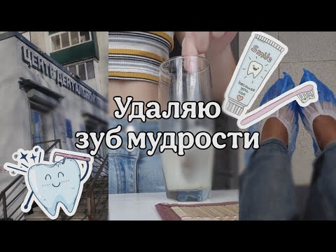 Видео: vlog: Как я удалила зуб мудрости
