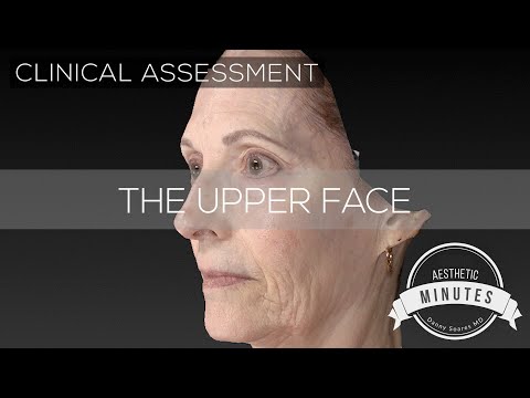 Видео: Подтяжка бровей и лица для женщин 67 лет | Эстетические минуты #BrowLift