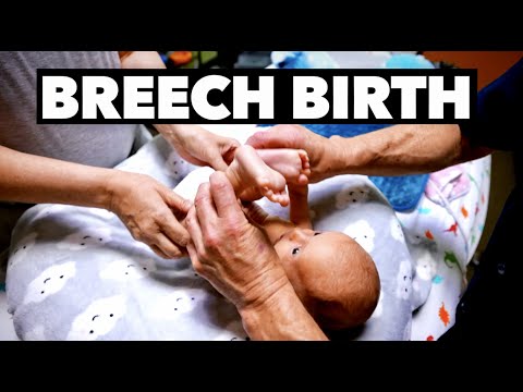 Видео: ОН НЕ МОГ ОПУСТИТЬ НОГИ ПОСЛЕ РОДОВ! (Фрэнк Брич) | Доктор Пол