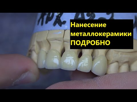 Видео: Наненсение керамики INLINE. металлокерамика программы обжига керамики. Как нанести керамический зуб?