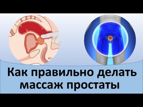 Видео: Как правильно делать массаж простаты