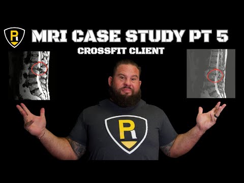 Видео: Пример исследования МРТ, часть 5: сравнение результатов клиента CrossFit за несколько месяцев