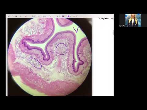 Видео: Як відрізнити мікропрепарати по травній трубці?